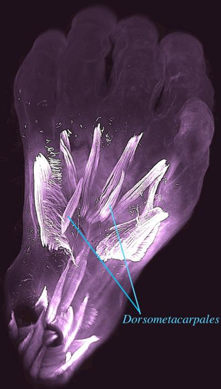 The dorsal view of the left hand of a 10-week-old human embryo, with the dorsometacarpales highlighted.